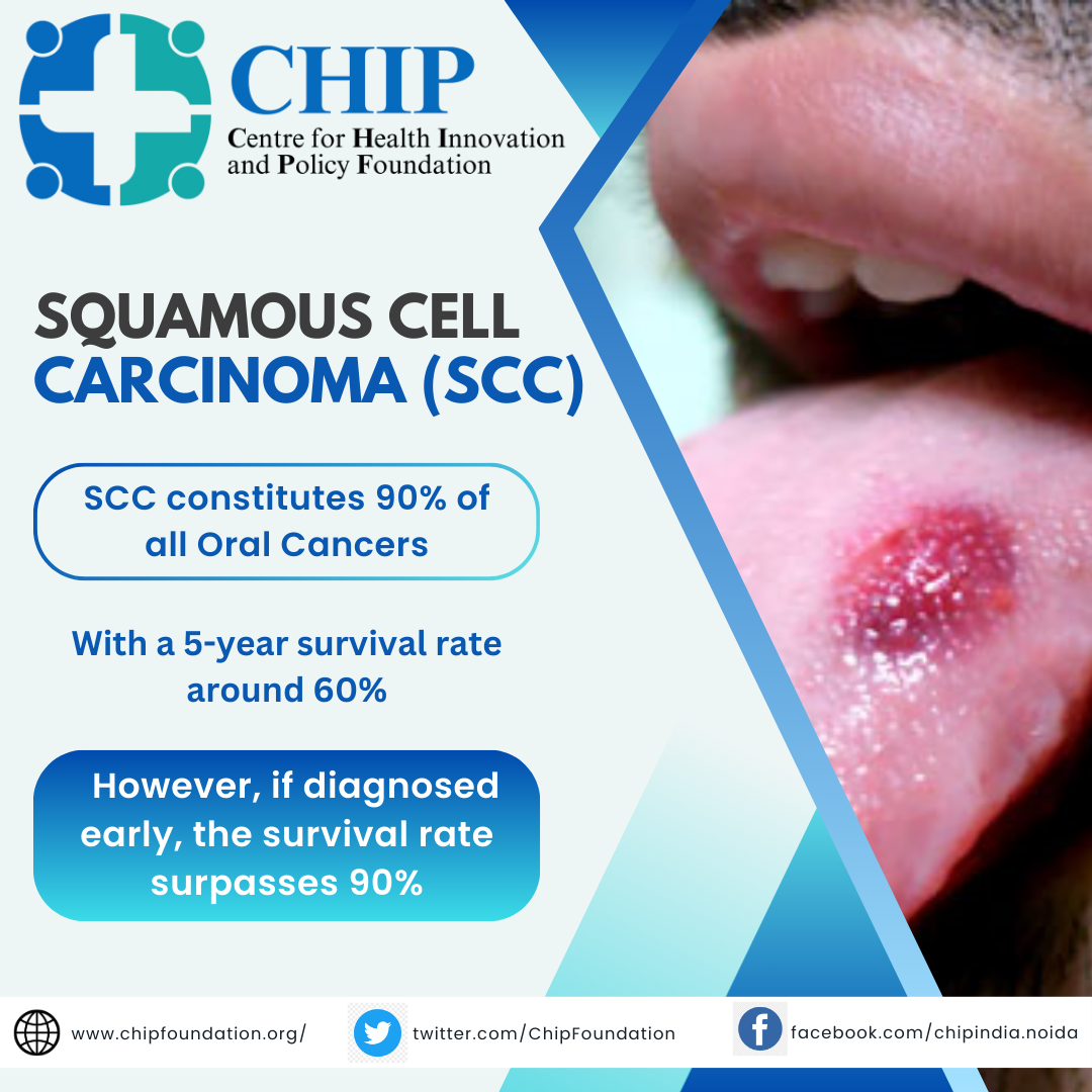 Squamous Cell Carcinoma (SCC)